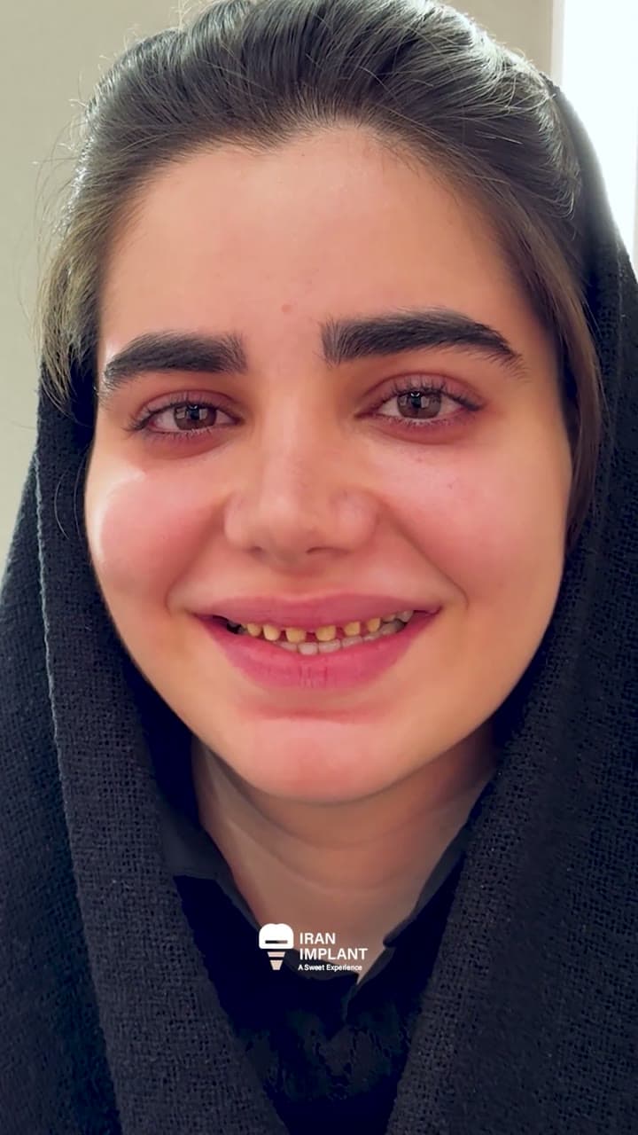 تصویر نتیجه درمان مرضیه سورتیجی